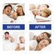 Смужки для забезпечення носового дихання уві сні Sleep Strips Для всієї родини 30 шт PK053 PK053 фото 7