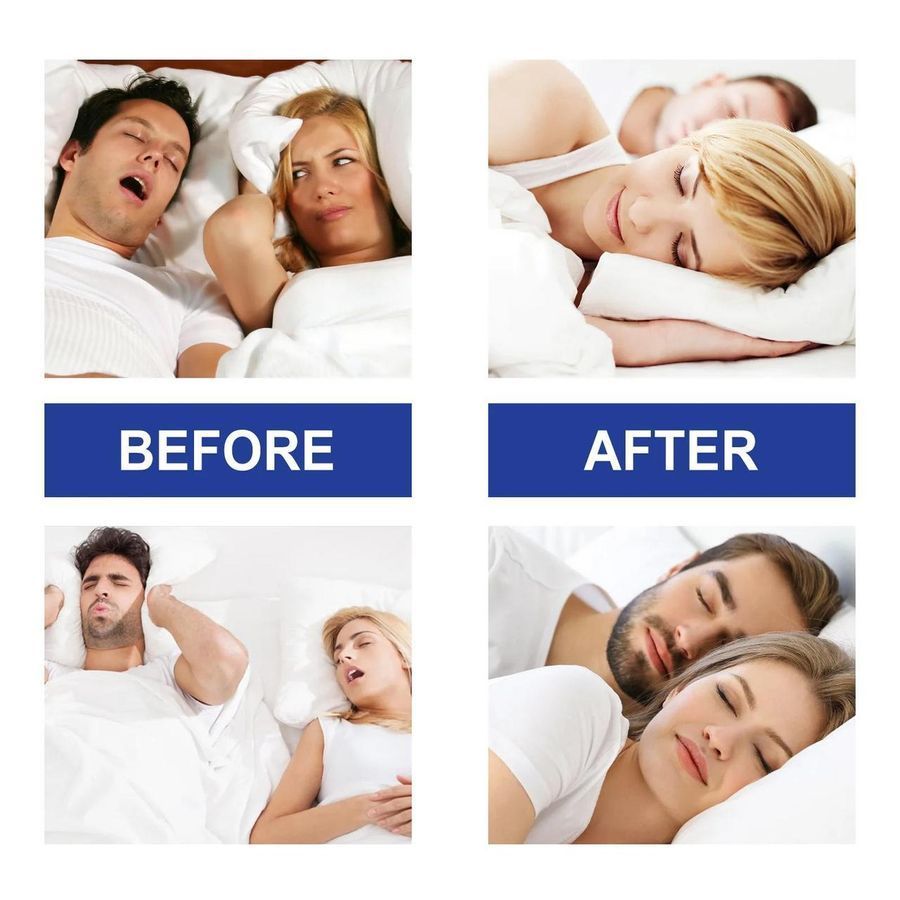 Смужки для забезпечення носового дихання уві сні Sleep Strips Для всієї родини 30 шт PK053 PK053 фото